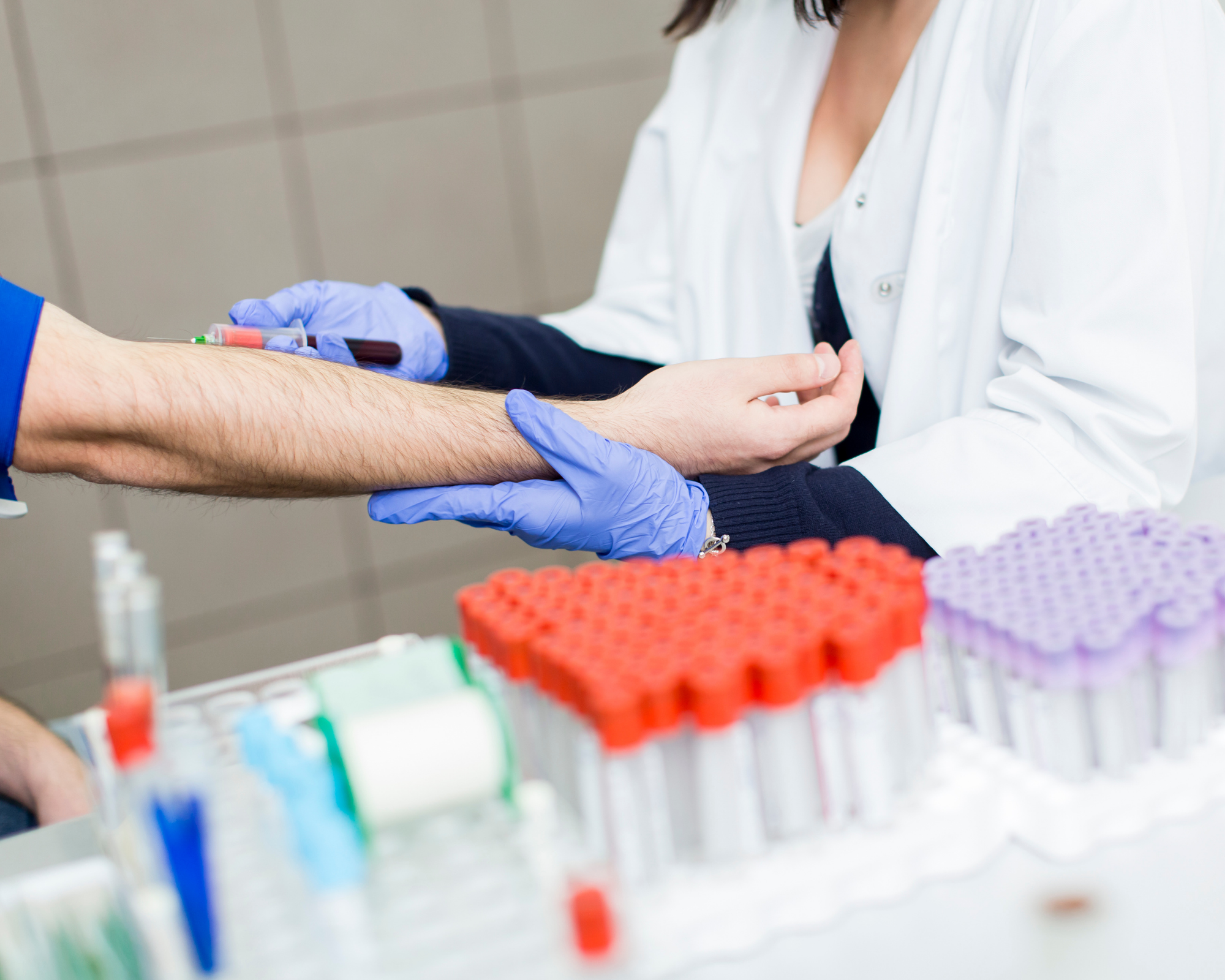 Laboratuvar Tetkikleri 