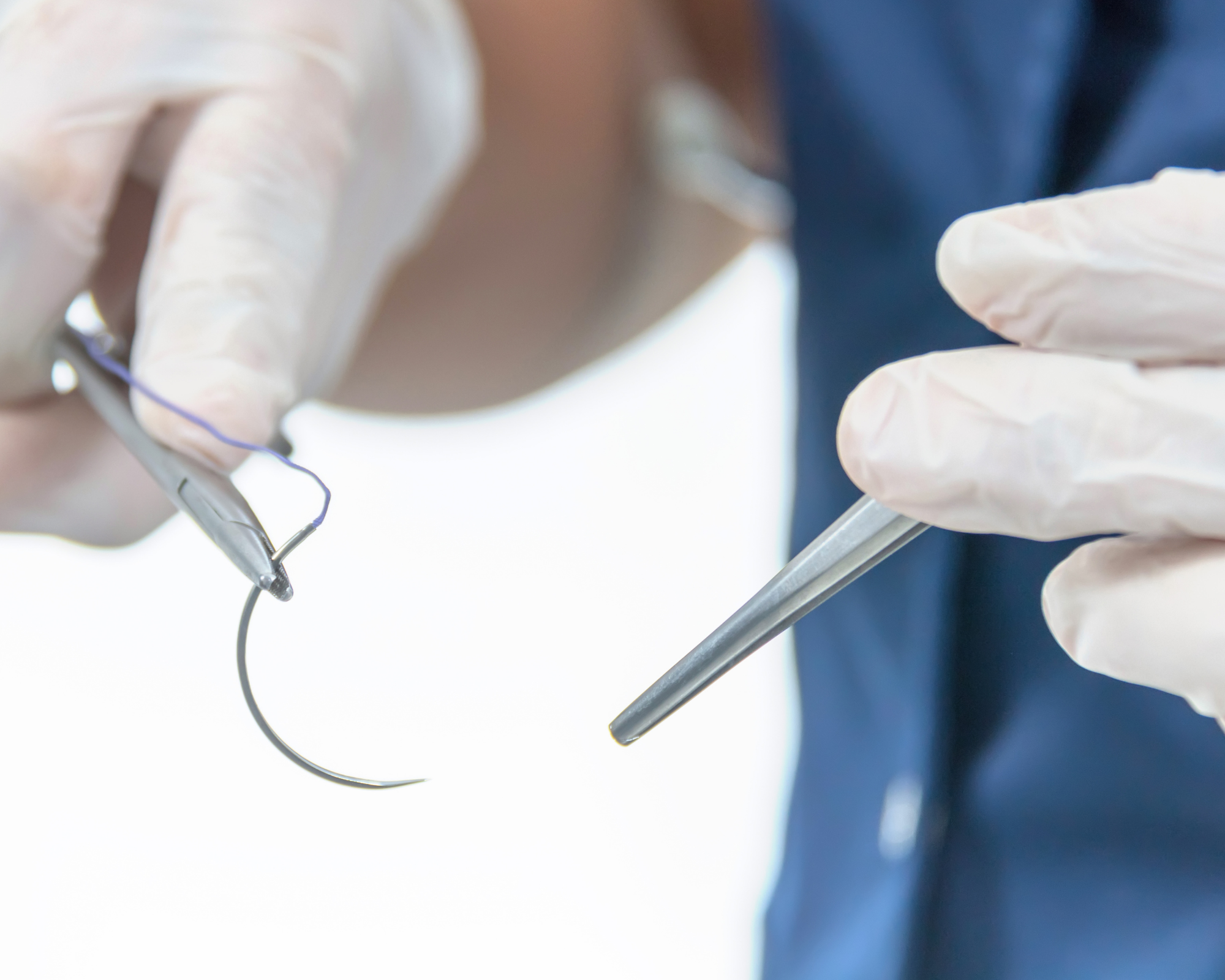 Sütur (Dikiş) Atma & Alma 